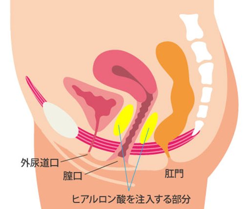 膣の壁（外側）