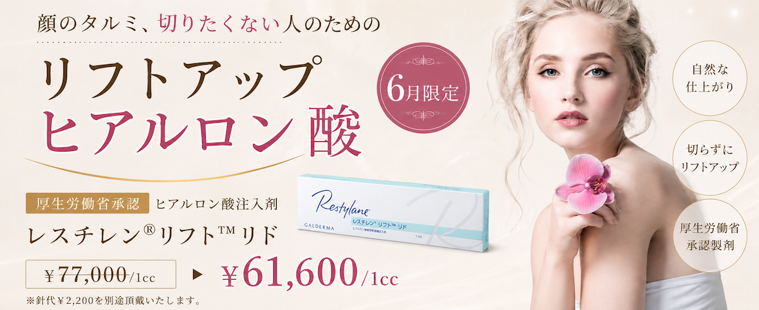 レスチレン®リフト™リド